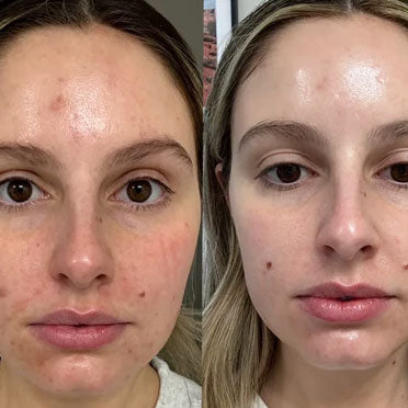 LSOLOWEY before and after